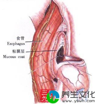 食管憩室