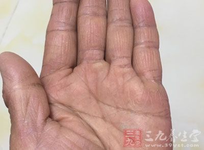 按摩手法 按摩10大穴位让你补肺益肾更长寿