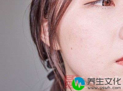 激光去除眼角皱纹