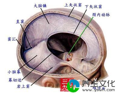 慢性硬膜外血肿