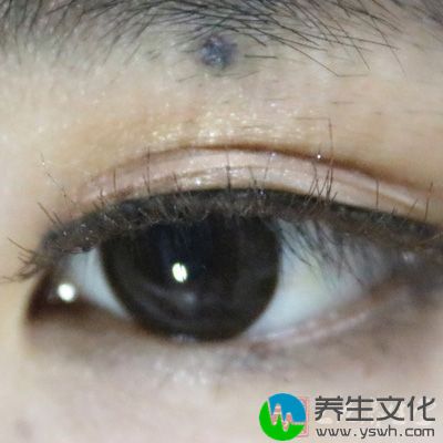 眼睛疲惫、发痒、干涩或流眼泪