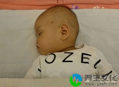 本病好发于婴幼儿童，夏秋多见，有时一家数个儿童同时发病