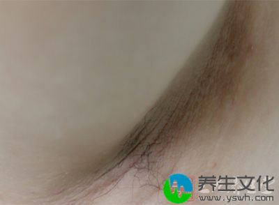 女性的汗腺分布主要局限于腋下