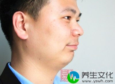 黄褐斑一般是长在女人脸上的，但是也有男人黄褐斑