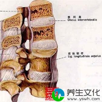 腰椎间盘脱出