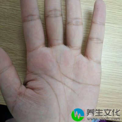 婚姻线向下开叉最终接触到感情线，则表示感情不顺