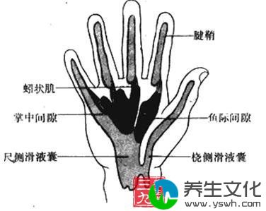 手掌深部间隙感染