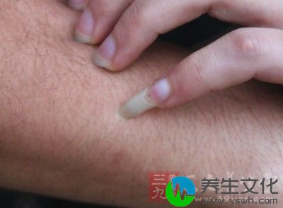 它可以通过消化道、呼吸道、皮肤损伤和眼结膜等多种途径传播