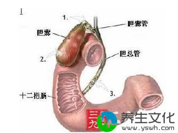 胆管炎