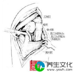 肱骨外科颈骨折