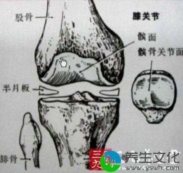 膝关节半月板损伤