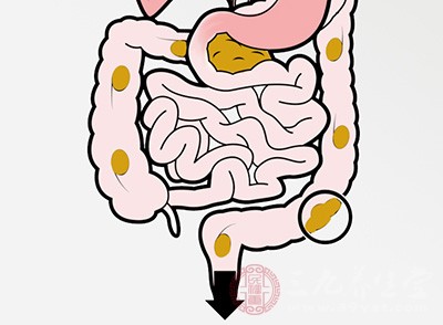 肠道癌症的早期症状 预防肠癌方法有哪些