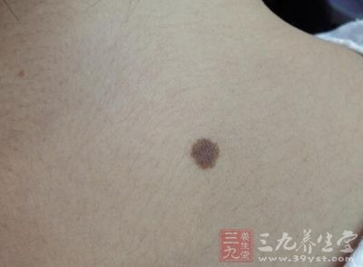 后背有这物的人不愁没钱花