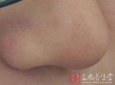 保健按摩 7种鼻子按摩法养肺健脾