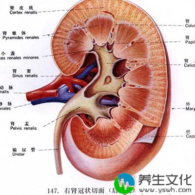 肾结石是泌尿系统的常见疾病之一