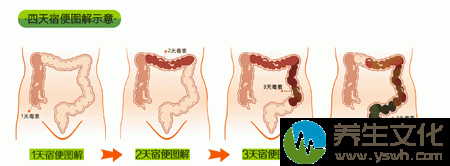 四天宿便图解示意