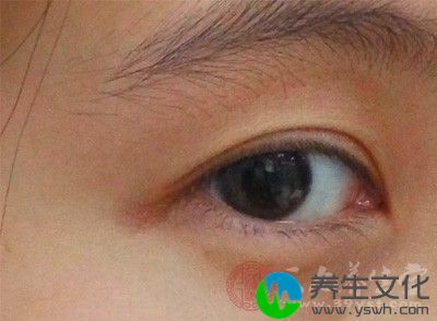 通常表现为频繁眨眼、揉眼睛、有黏性分泌物等