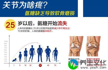 氨糖缺乏导致软骨磨损