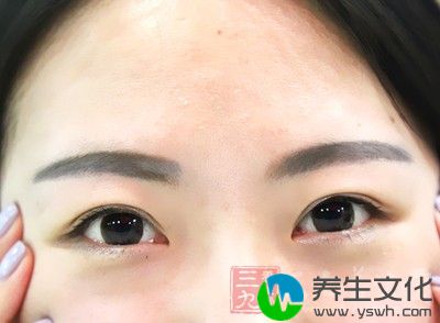 首先，我们要看眼睛的色泽和清澈度