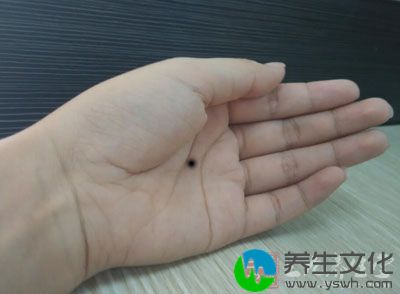 女人手掌有痣代表——上辈子约定这辈子结婚