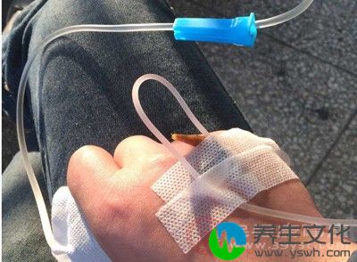 接触溶石，可以通过PTC注入辛酸甘油单酯等药物进行溶石排石