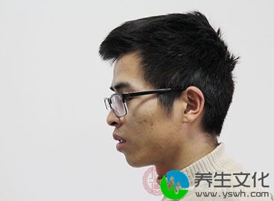 一般女性为基因传递者，男性为发病者