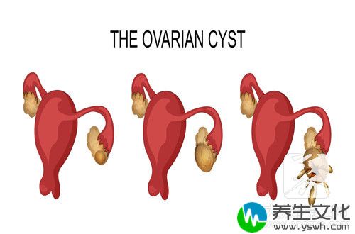 宫寒小腹会痛吗