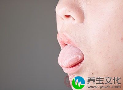 饮食不节制会导致舌苔发白