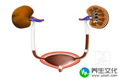  泌尿系结石好治吗