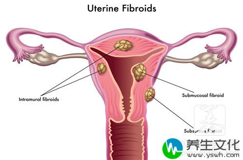 内膜炎严重吗