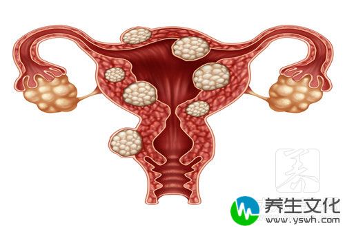 宫颈电灼术多久愈合