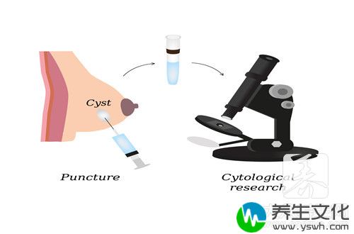 自我检查乳房