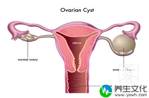  贫腔积液是什么