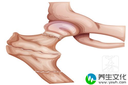 骨盆后倾的症状