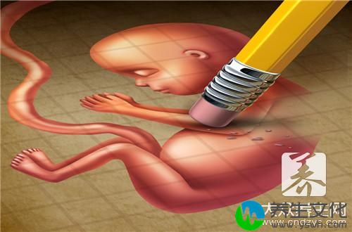 人流后乳房有奶水这是怎么回事？