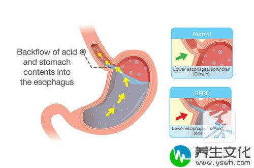 小孩胃不好吃什么能养胃