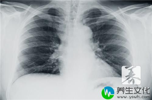 胸透怀孕6个月查出畸形