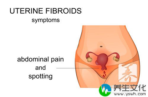 得了子宫肌瘤会有什么症状
