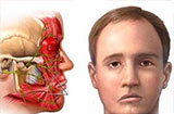 面瘫怎么办 推荐治疗面瘫的食疗方法