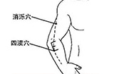 消泺穴主治头痛，颈项强痛，臂痛，齿痛，癫疾。​