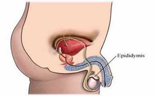 附睾炎早期有哪些常见症状 该如何鉴别诊断？